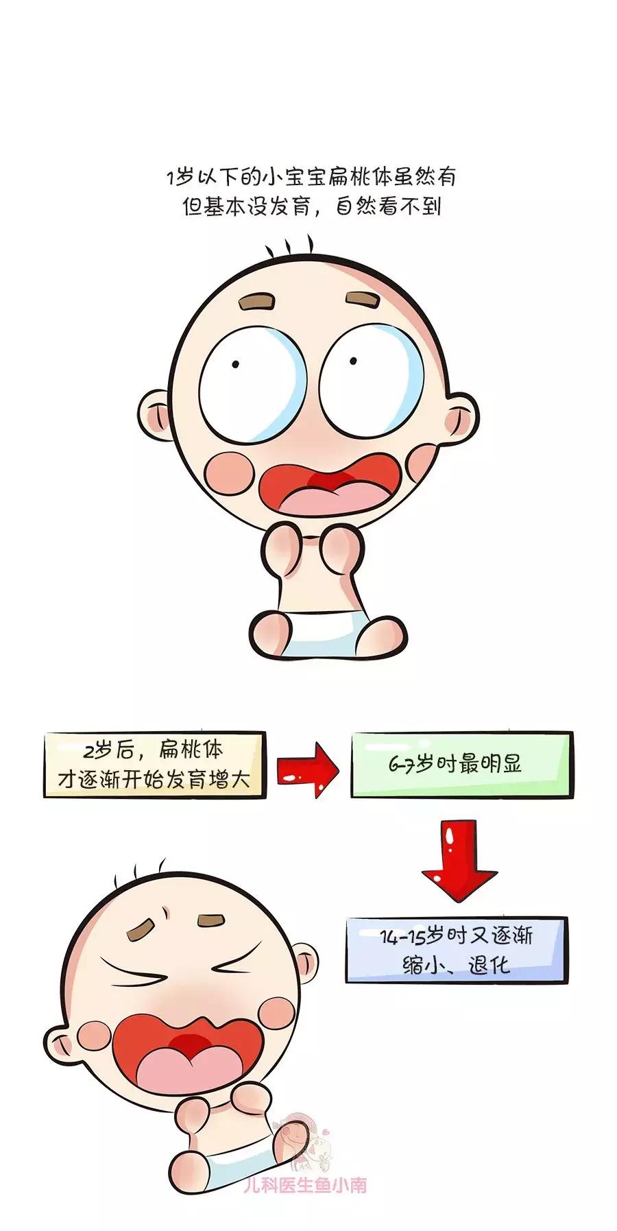 扁桃体切了喉咙还是老是发炎,扁桃体经常发炎该不该切