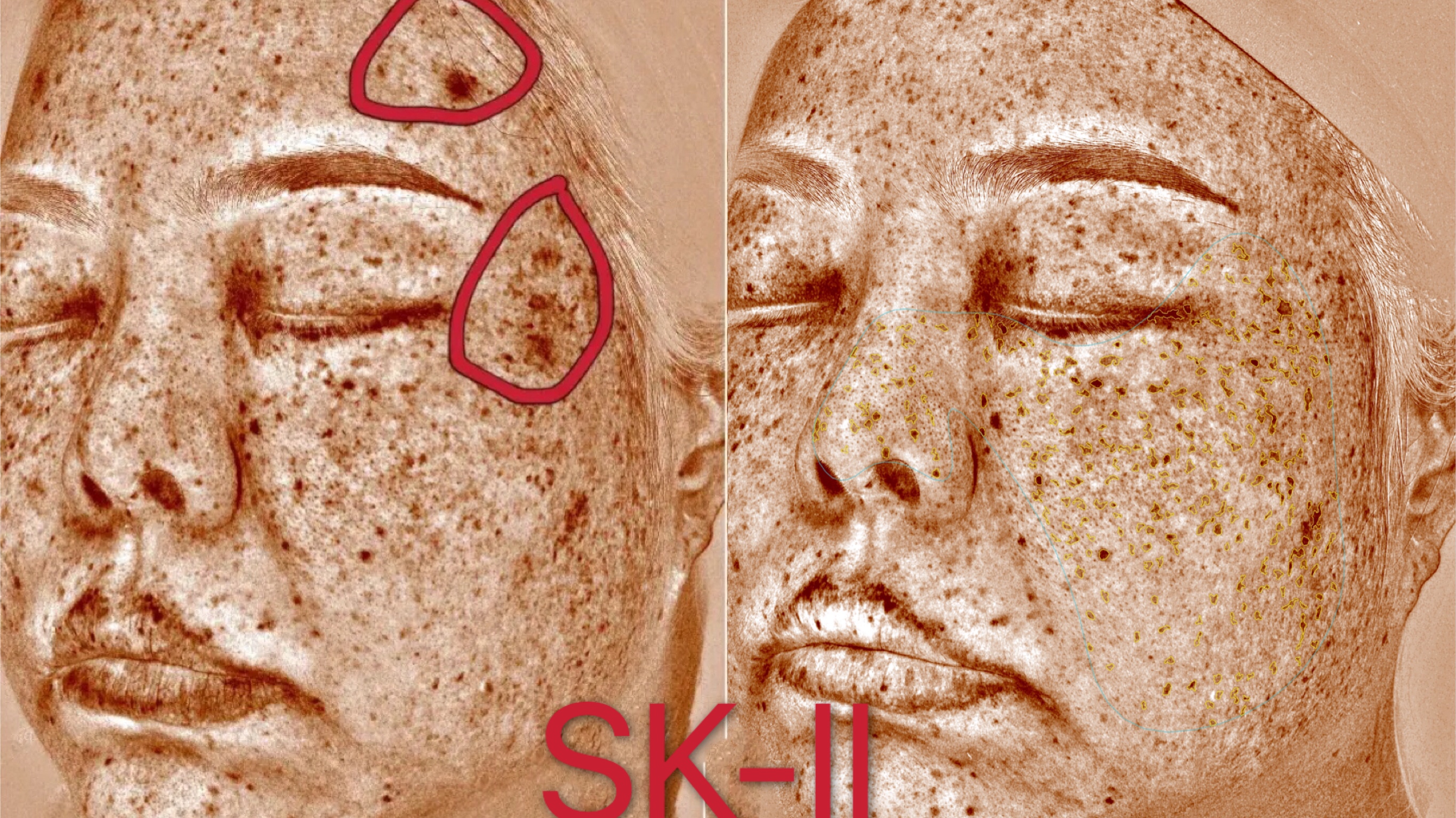 玉兰油大红瓶和skii大红瓶测评,玉兰油淡斑小白瓶和sk2小灯泡比较