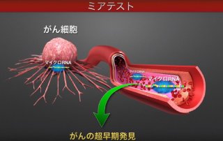 日本一滴血检测13种癌症仪器,日本一滴血检测出身体什么病