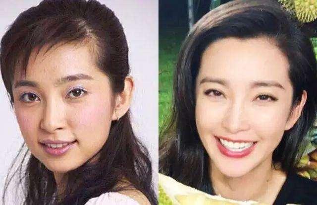 明星做烤瓷牙会做根管治疗吗,烤瓷牙的明星