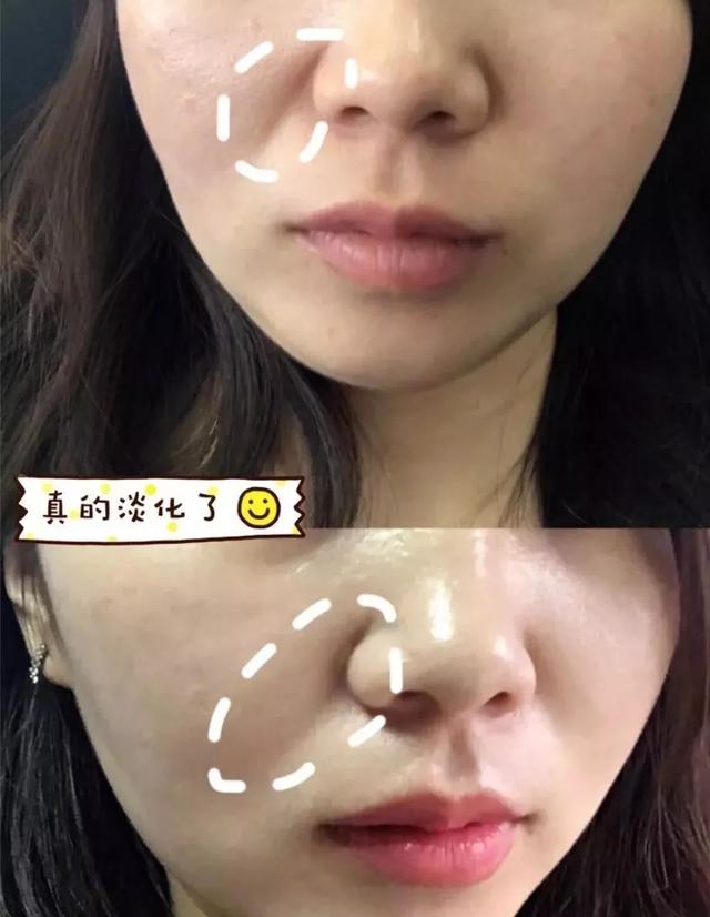 李佳琦推荐5款平价面霜,李佳琦推荐2019最值得买的面霜