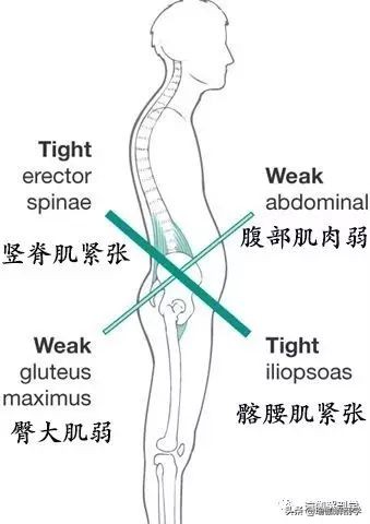 练瑜伽可以矫正骨盆前倾,练瑜伽时骨盆如何转动