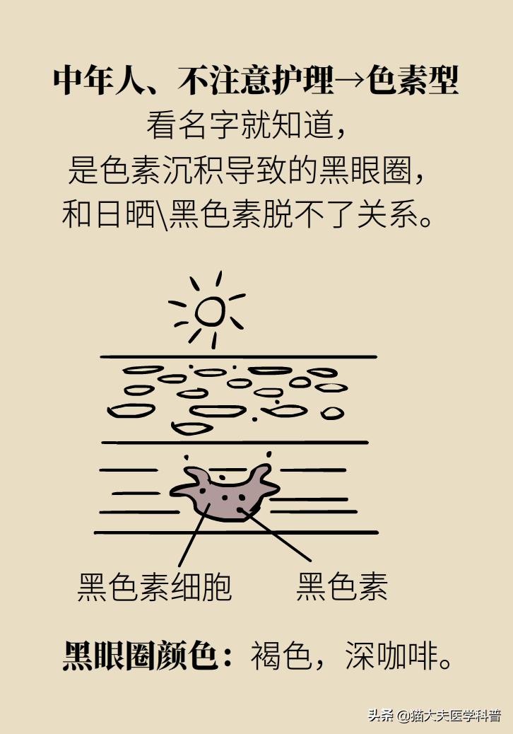 医生黑眼圈,手术消除黑眼圈靠谱吗