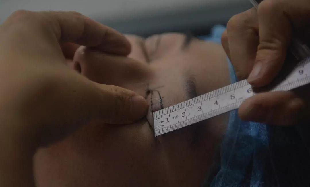 为啥女人大都是双眼皮,为什么女生那么在意双眼皮