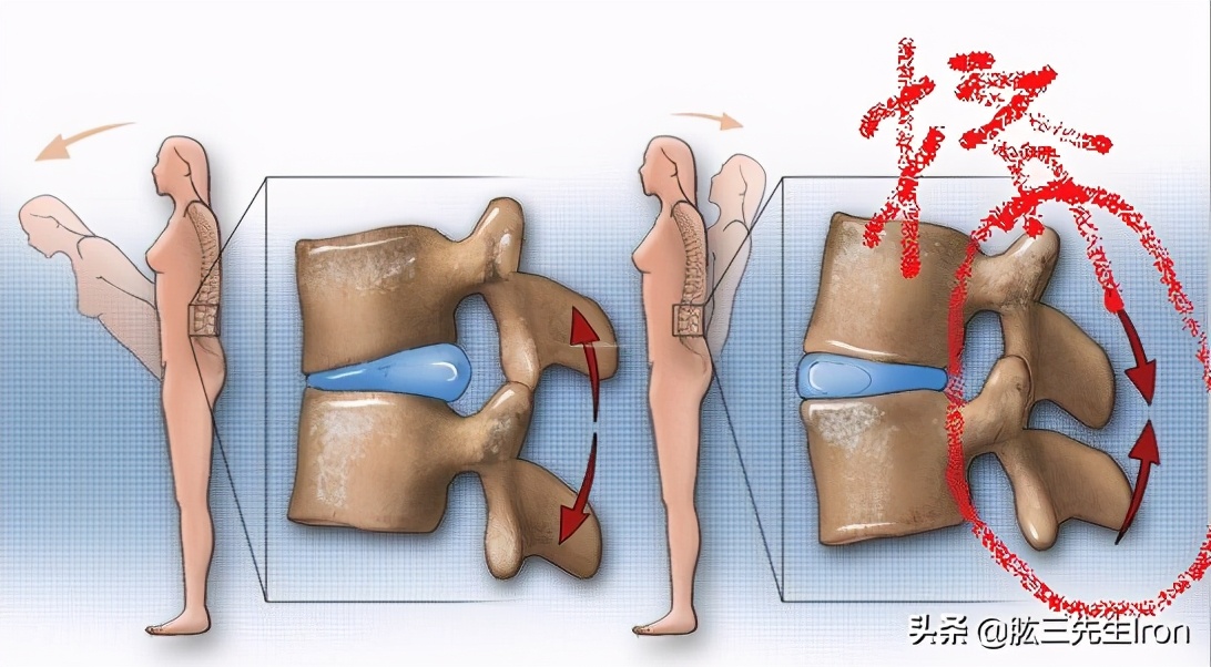健身腰部肌肉损伤怎么恢复,健身腰肌损伤要多久才能再次运动