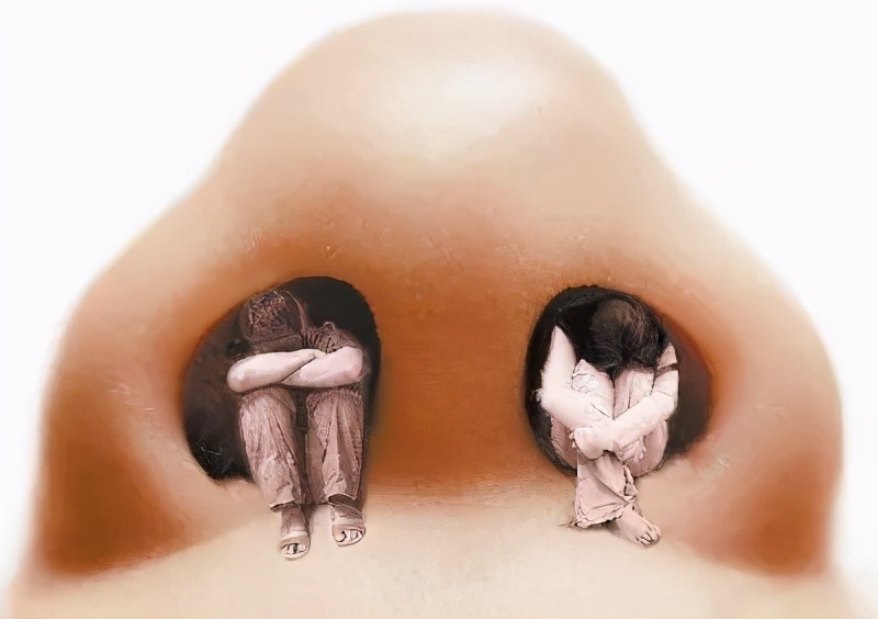 鼻中隔偏曲可引起鼻塞鼻出血,鼻中隔偏曲鼻出血用什么药