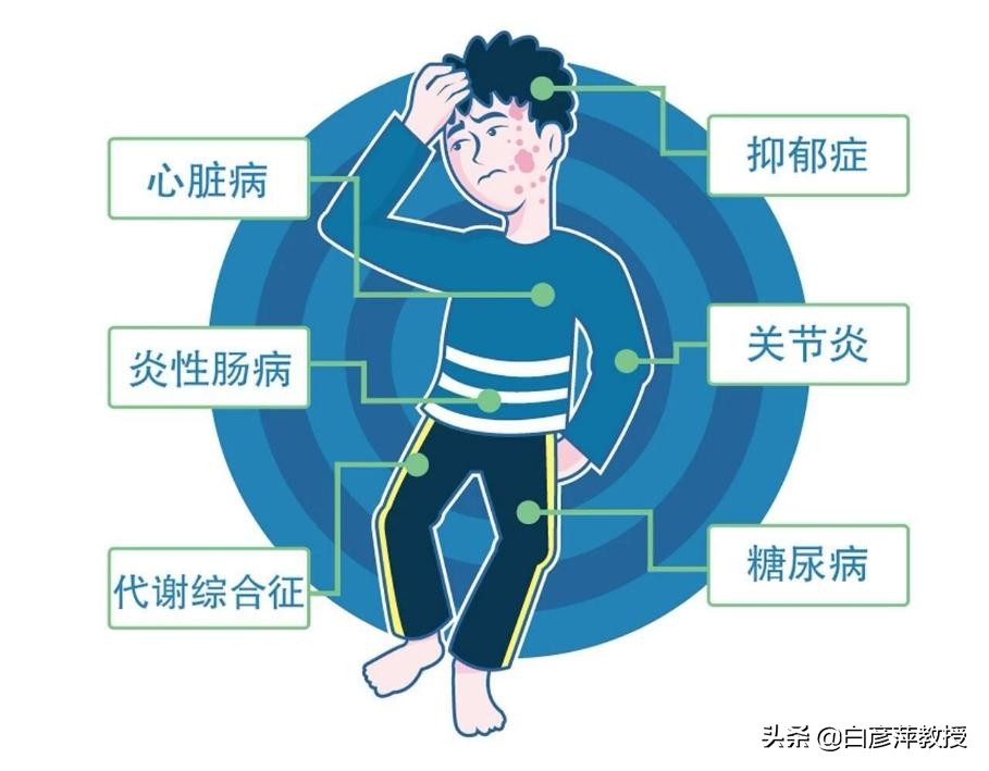 关节痛是风湿吗用什么药效果好,风湿关节炎和银屑病有什么区别