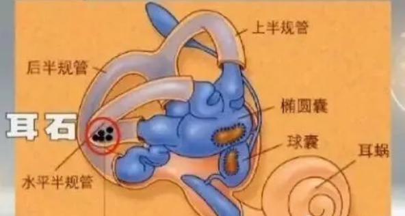 @家长们，神兽上网课头晕？带个“眼镜”辨真伪！