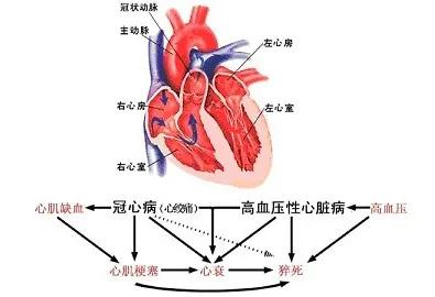 高血压心脏病高发,得了高血压病怎么办