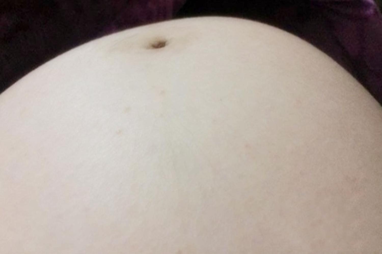 孕期肚子一边高,孕期肚子一边高一边低是臀位吗