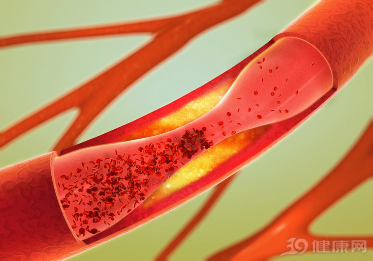 血管好的小秘诀,好血管