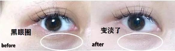 去眼纹去黑眼圈用什么方法,去眼袋黑公认最好用的土方法