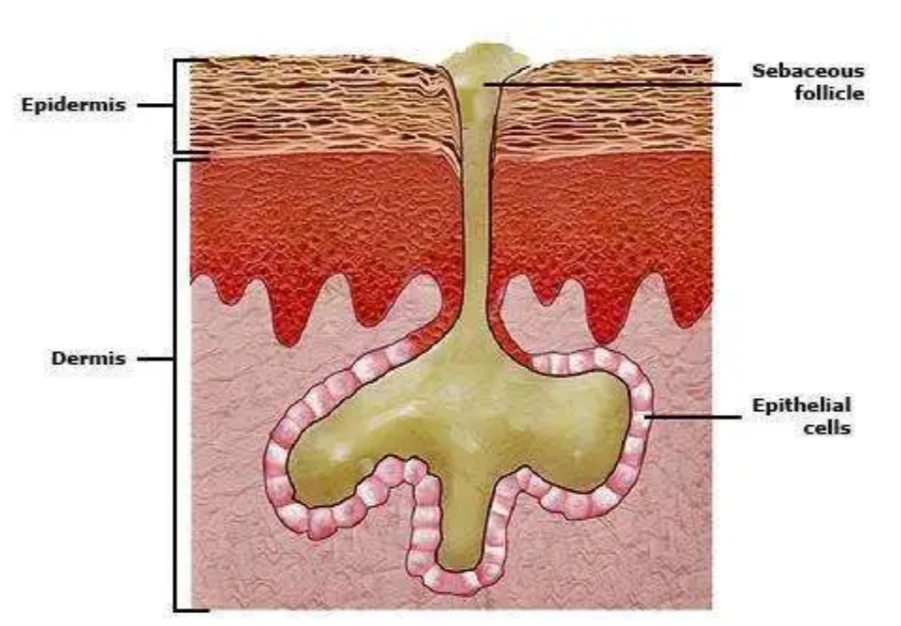 皮脂腺怎么处理,皮脂腺大怎么办