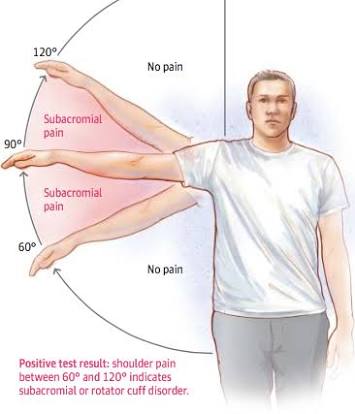 肩膀疼痛要警惕的三种病怎么治疗,肩膀疼痛要警惕的病怎么治疗