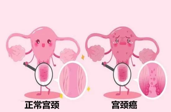 子宫的故事（三）——生命的摇篮（子宫结构）