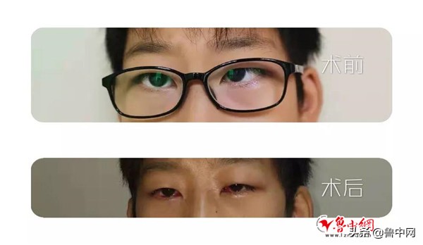 淄博康明爱尔眼科医院王琪,康明爱尔眼科医院淄博活动