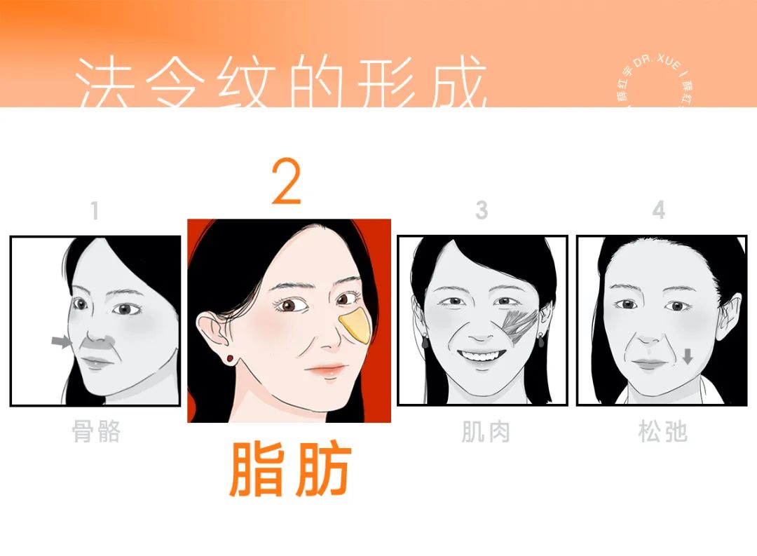 法令纹怎么改善脸部衰老,改善法令纹按摩手法视频