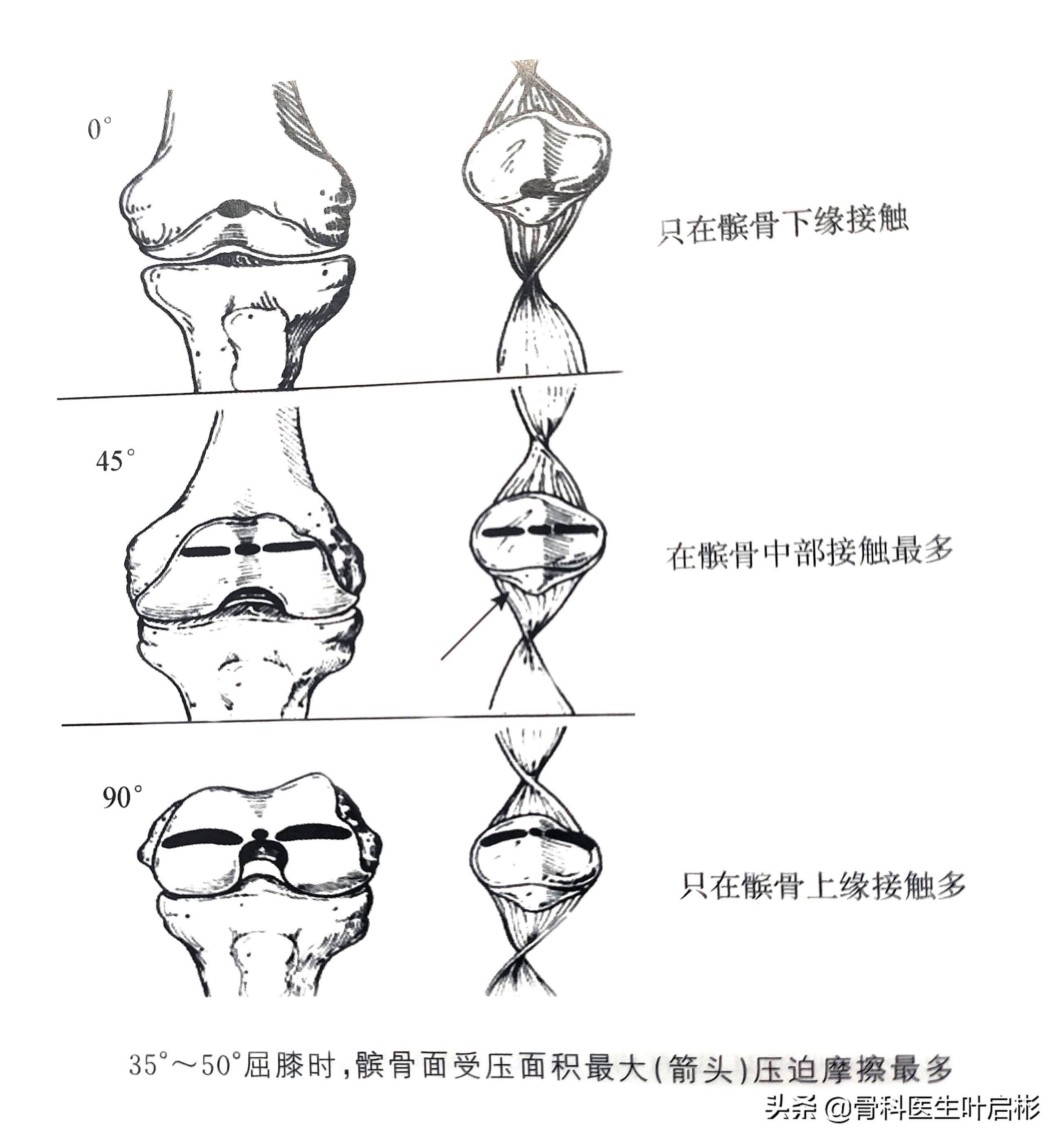 治疗腰背酸痛的养生方法,治疗腰背疼的训练