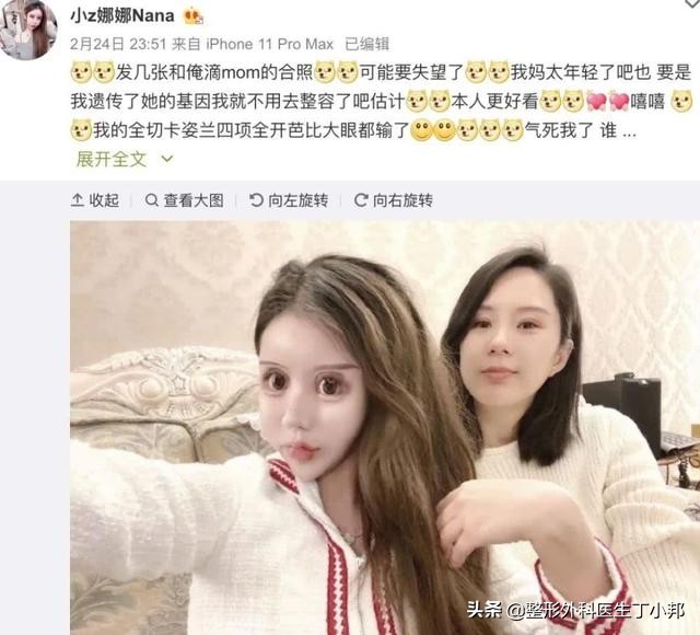 整容成功逆袭的女人,整容整形成功逆袭案例