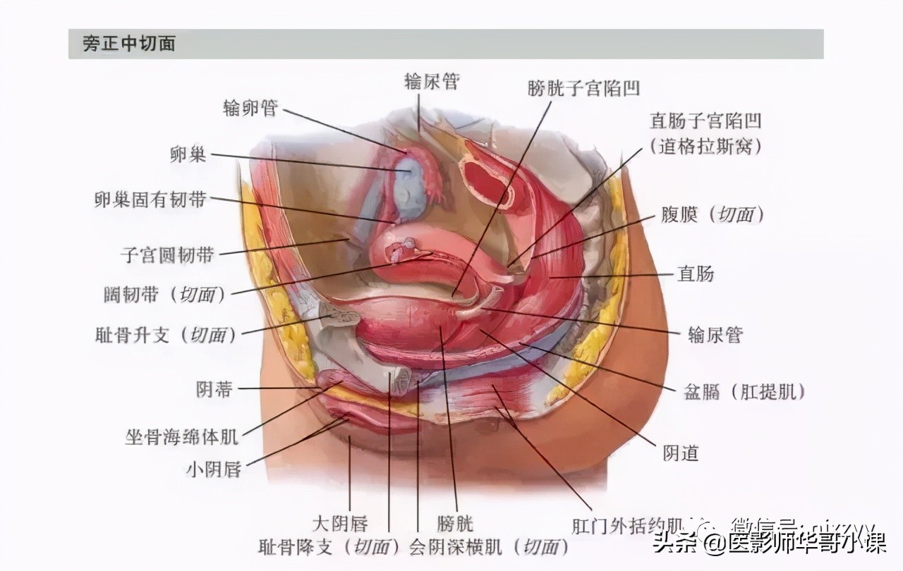 女性盆腔核磁解剖图谱,正常盆腔ct解剖图谱