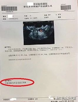 多囊卵巢综合征患者能自然怀孕吗？