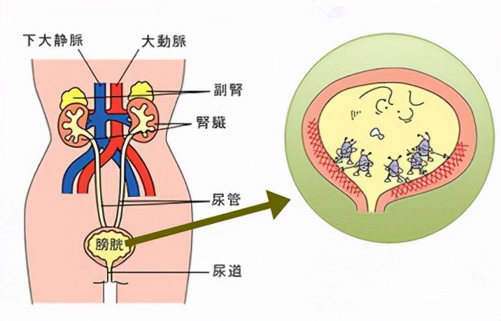 闻尿液能判断怀孕吗,通过尿来判断病
