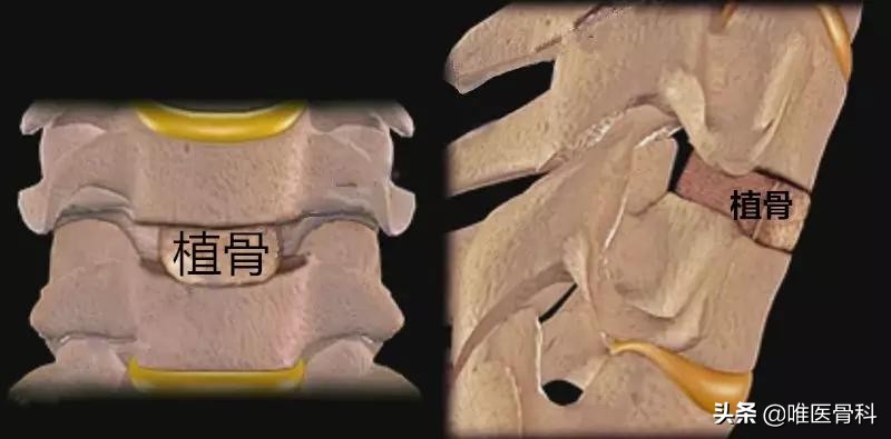 乳腺微创手术和开放手术的区别,开放手术和微创手术的区别