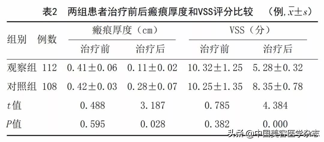 注射曲安奈德治瘢痕疙瘩,结节性痒疹曲安奈德皮下注射