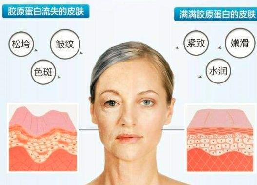 家用射频美容仪有用吗专家讲解,家用射频美容仪有效果吗