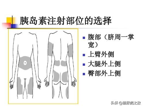50岁的人餐后血糖11.8,打了胰岛素饭后血糖15怎么办