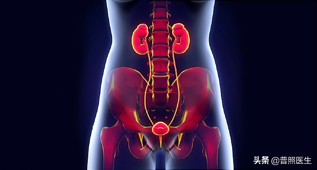 尿路小结石怎么治疗,为什么结石医生不建议做激光