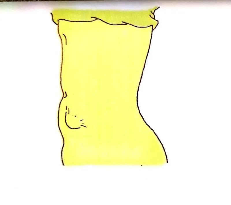 有了这些症状建议您做个肠镜,有什么症状需要做肠镜