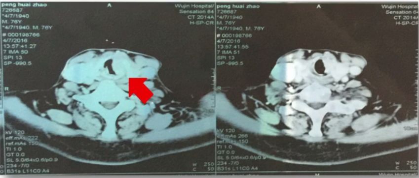 仓静简历,中山医院麻醉科主任仓静