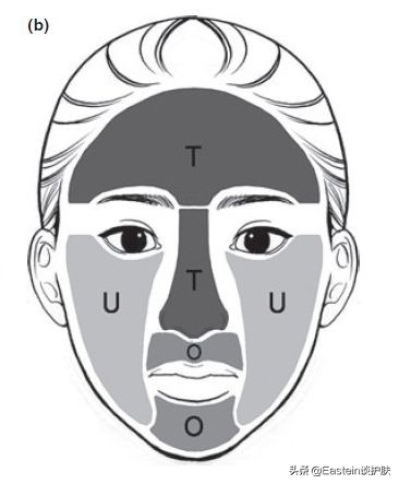 你的皮肤有多差,你的皮肤不好的原因