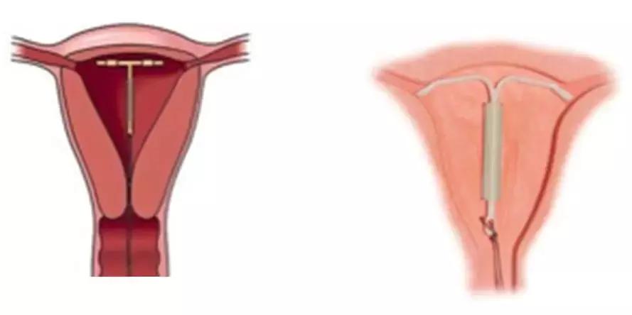 科学避孕关爱健康,科学高效避孕护航生殖健康