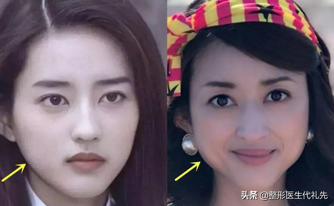 快来看看你的脸为什么会越变越宽,哪些可能会影响脸越来越宽