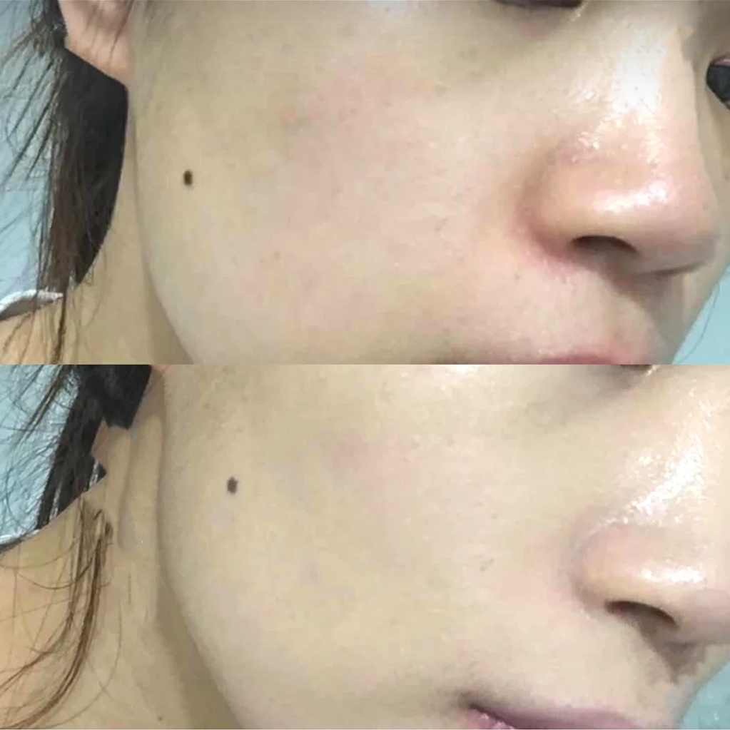 气垫和粉底液哪个更水润,大干皮推荐粉底液气垫