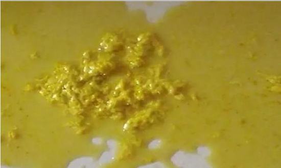 宝宝腹泻教你一招搞定,宝宝腹泻怎么才能彻底治愈