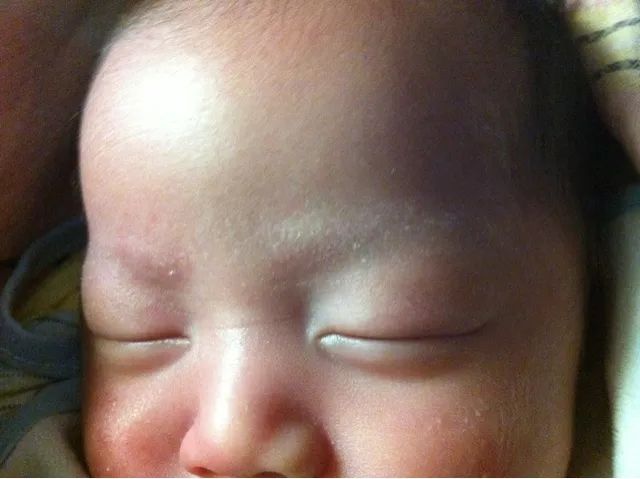 八个月宝宝单眼皮逆袭双眼皮,单眼皮宝宝早日逆袭成功变双眼皮