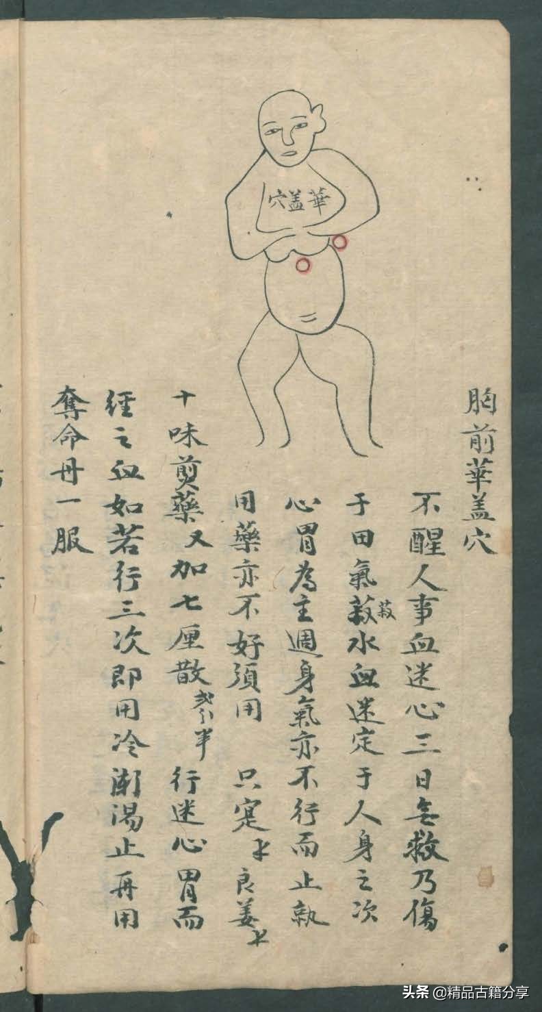 中医类抄本跌打损伤方面的医书欢迎阅读