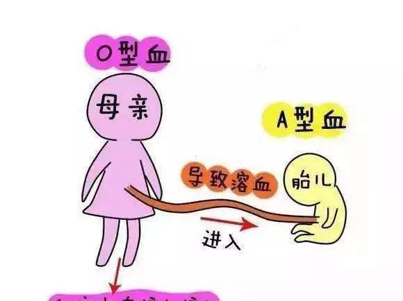 溶血症症状,溶血症在怀孕早期有什么症状