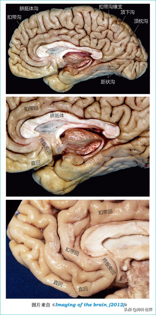 脑解剖学讲解视频全集,脑功能解剖学习