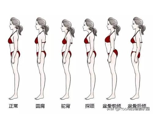 产后妈妈肋骨外翻外扩的危害,肋骨外翻是什么原因造成的女性