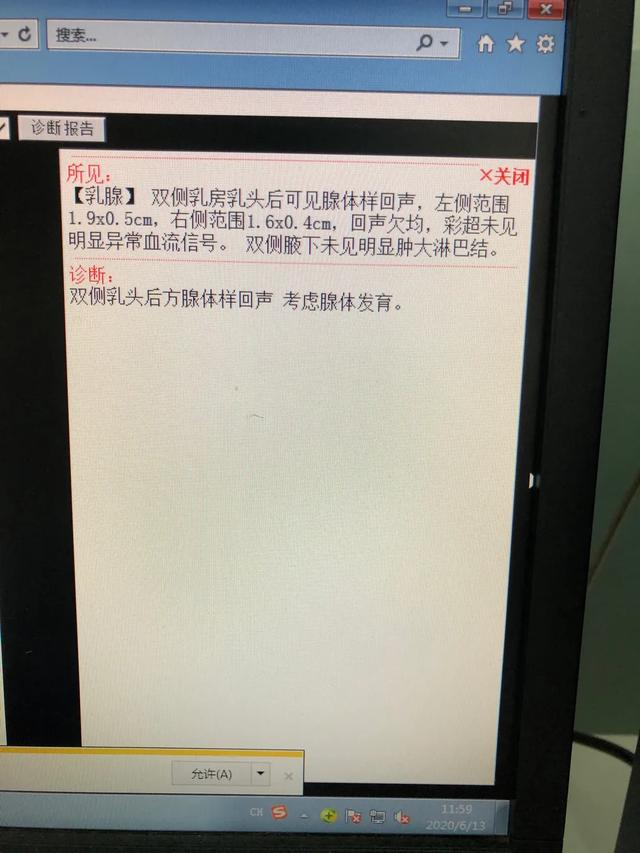 儿童性早熟要做哪些检查？怎么根据这些指标判断真性还是假性？