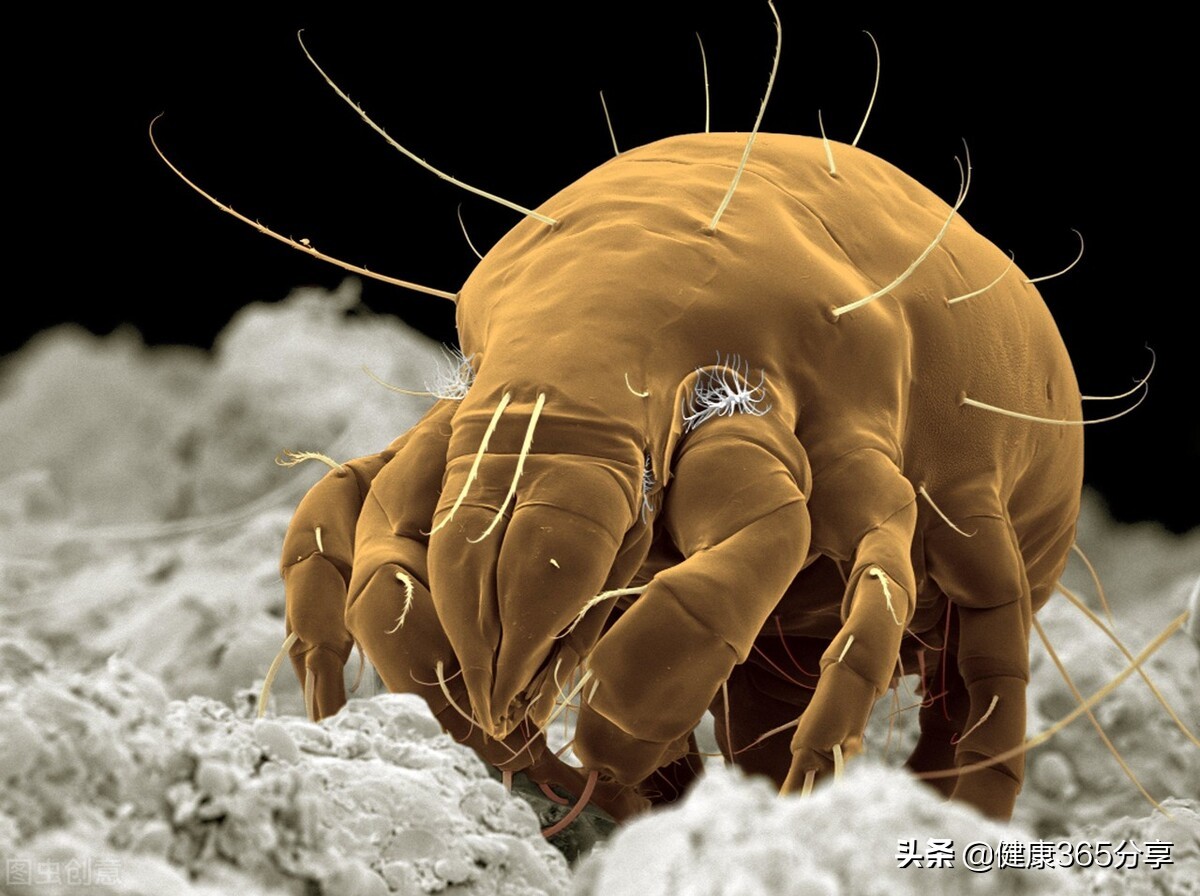 被虫子咬了要警惕四种病,被虫子咬了去看医生怎么治疗