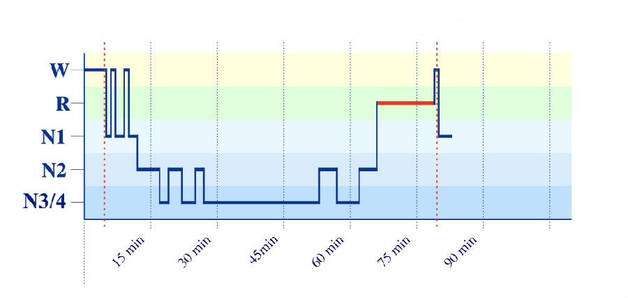一分钟快速入睡法拯救熬夜失眠,熬夜睡不着怎么恢复正常睡眠