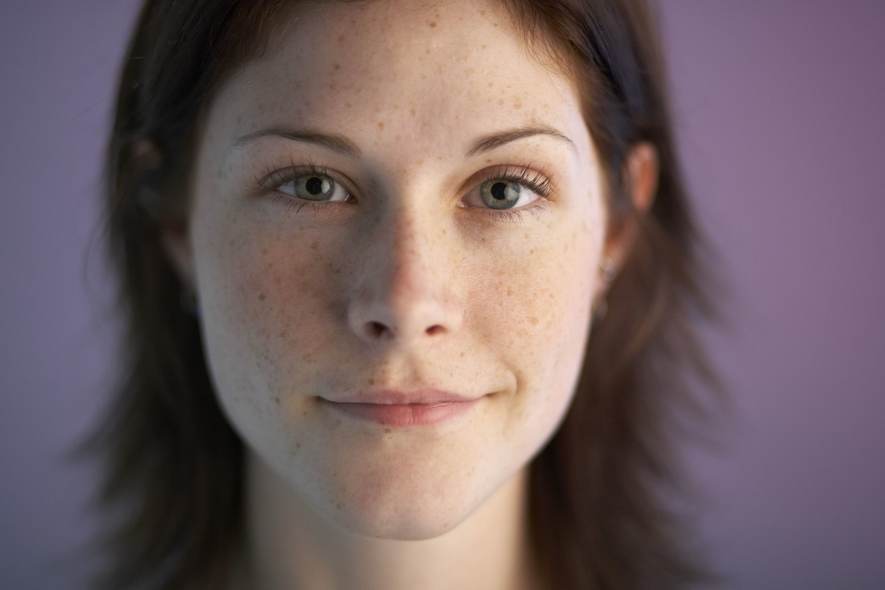 雀斑，很多人脸上比较常见。可是你知道去雀斑的好方法吗