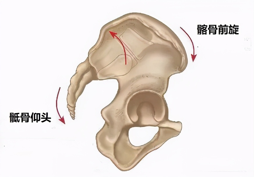 生宝宝选择剖腹产也需要做盆底肌修复，越早越好莫拖延