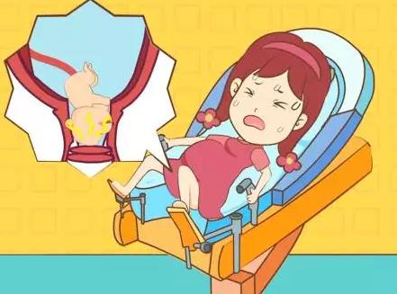 顺产和剖腹产的优缺点分别是什么？搞清楚了少遭罪！