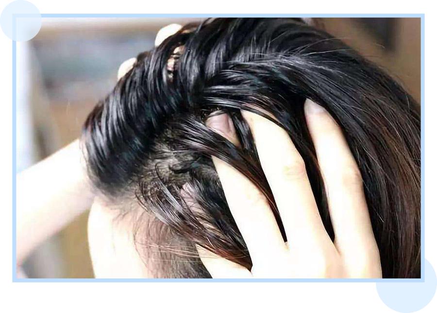 鞠婧祎全身造假,鞠婧祎头皮都整了吗